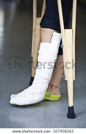 Close-up photos of foot splint for treatment of injuries from broken bones.
