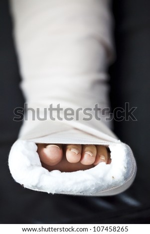 Close-up photos of foot splint for treatment of injuries from broken bones.