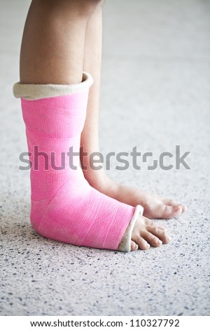 Close-up photos of foot splint for treatment of injuries from ankle sprain.