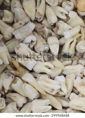 Collection of extracted teeth