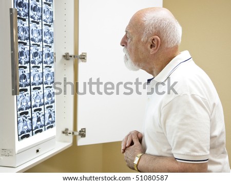 Confused senior man in chiropractors office,  looking over the CT scan of his spine.