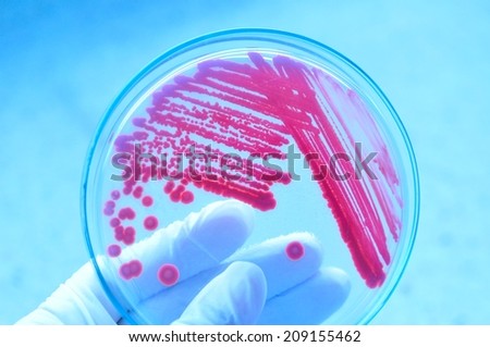microbiology laboratory test