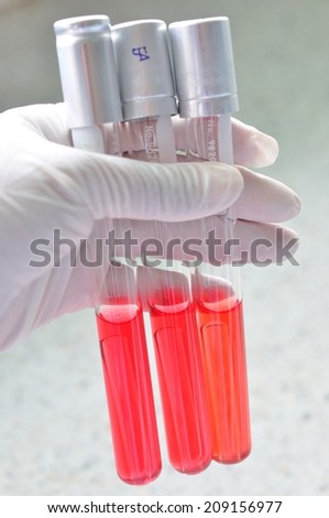 test tube of microbiology laboratory test