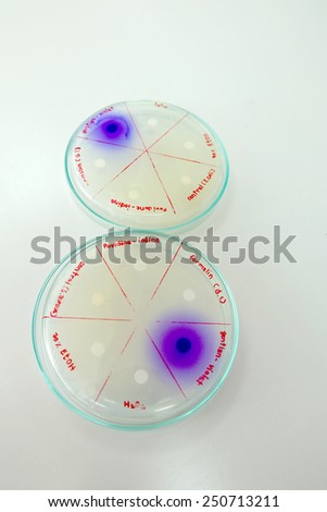 selective media for s.aureus in microbiology laboratory test