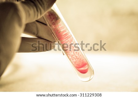 microbiology laboratory test with old color style
