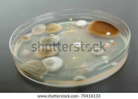 petri dish with agar and bacterium colony on grey table top