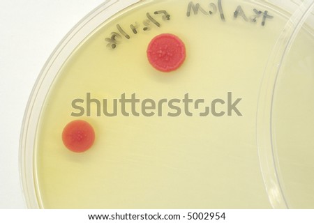 Microbial growth on petri plate