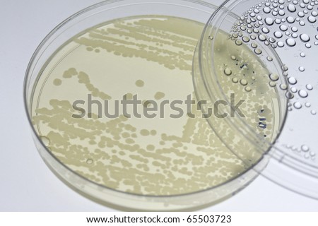 stock photo : Bacterial T-streak on agar plate