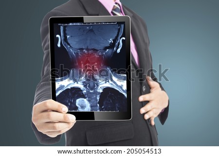 Businessman hold smart touch pad screen for neck x-ray film in studio