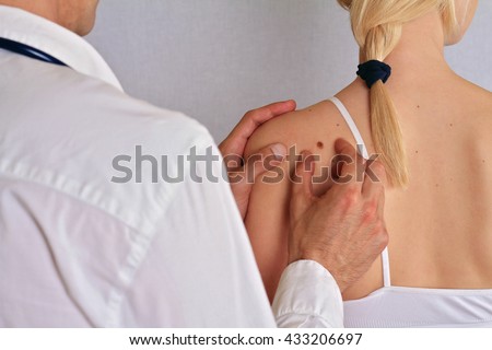 Dermatologist examines a birthmark of patient. Checking benign moles. Skin tags removal.