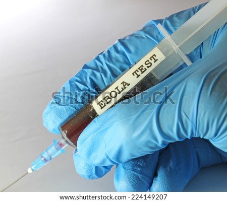 hand protected by gloves blue with the syringe containing the blood to test ebola virus in medical laboratory