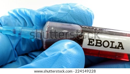 doctor\'s hand protected by gloves blue with the syringe containing the blood to test ebola virus in medical laboratory