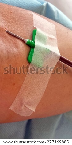 blood donor during the transfusion at the hospital with the needle in the arm