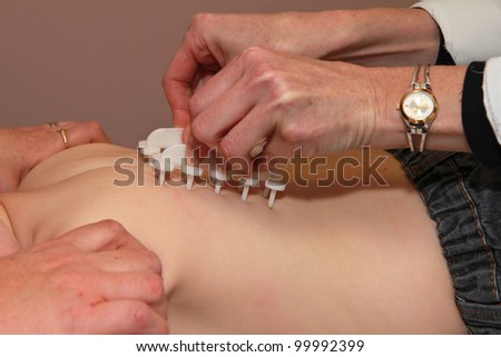 Pediatric Allergy Skin Test