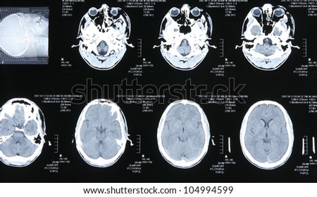 Magnetic resonance images of the human body. Head MRI or CT images