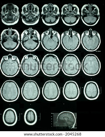 A sheet of MRI (Magnetic Resonance Images) of the brain