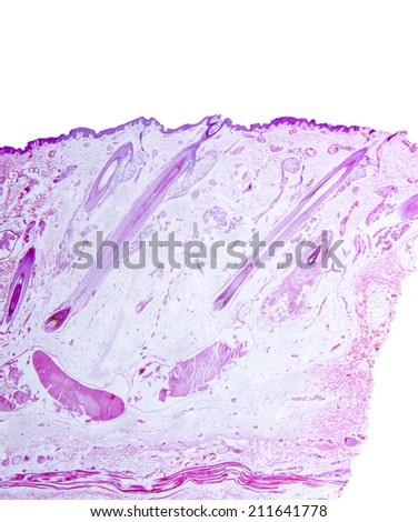 Human Scalp Hair Shafts, longitudinal section. Increased detail from stacked images. Isolated on white.