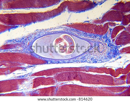 Microscope photo of Trichinella spiralis which causes trichinosis. Focus = the center larvae.