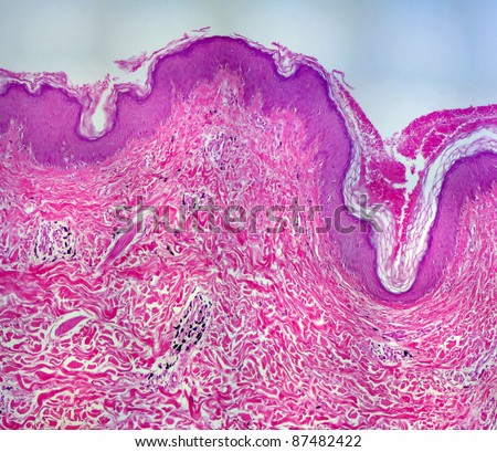 real tattoo photomicrograph shows the tattoo ink, (the black spots) in the dermis of human skin. 10x objective. Panorama.