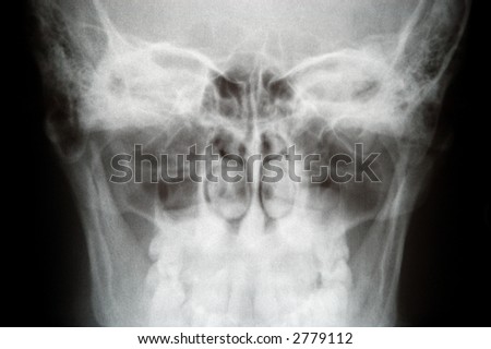Human X-ray picture (head bones)