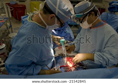 Open heart cardiac bypass surgery in operation room