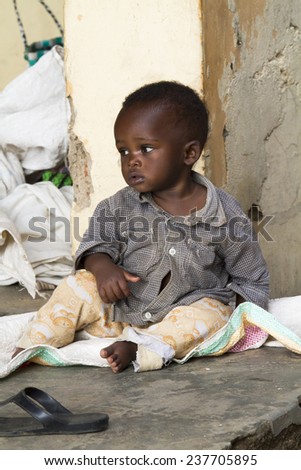 MAYANGE; RWANDA - NOVEMBER 13: Unidentified child from the UN Millenium village at November 13; 2013. It is a village of returnees-who came back to Rwanda after the 1994 genocide.