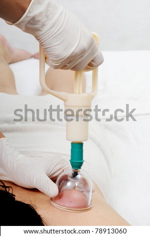 Medical cupping therapy process which vacuum the cup to penetrate dirty blood to the target cup