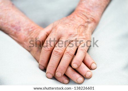 Two elderly hands representing the passing of time.