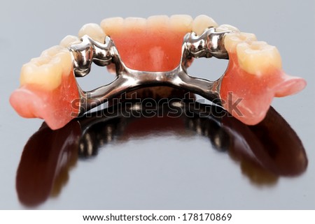 A closeup of a dental skeletal prosthesis with porcelain crowns and dolder.