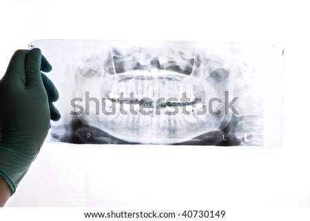 A closeup of a panoramic radiography, a dentist holding it in her hand, pointing with a probe