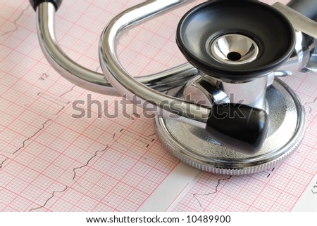 Atrial Fibrillation Ekg. with atrial fibrillation