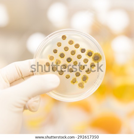 Close up of cell culture samples on LB agar medium in petri dish.  Agar plates are used by biologists to culture cells, mold, fungi, bacteria or small moss plants.