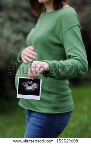 Woman holding ultrasound scan of pregnancy