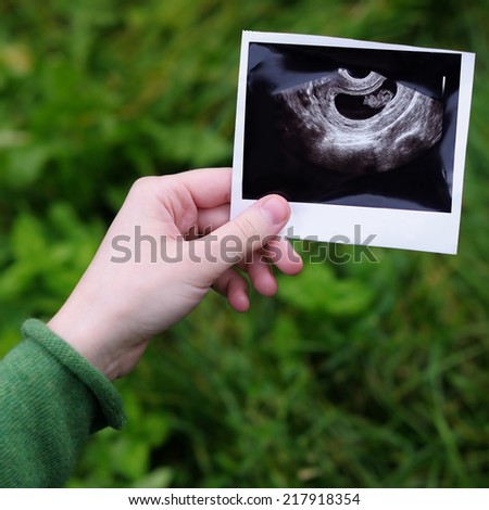 Woman holding ultrasound photographs of pregnancy
