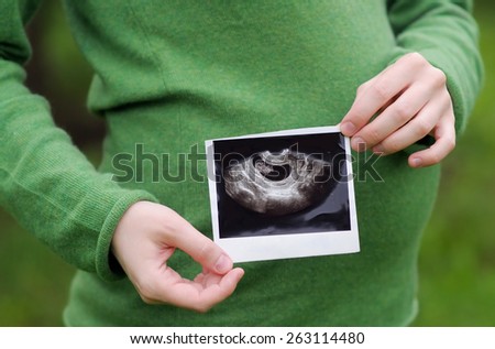 Woman holding ultrasound photographs of pregnancy