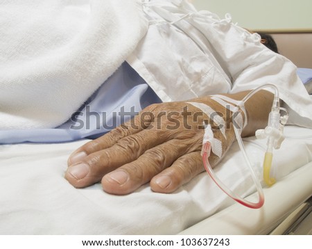 Arm of a female patient in the hospital with an IV