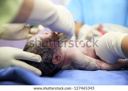 Newborn baby in labor room