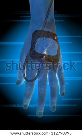 Hand With Iv