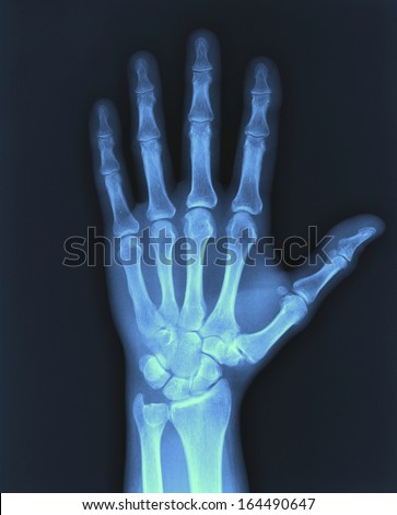 X-ray hand  / Many others X-ray images in my portfolio.