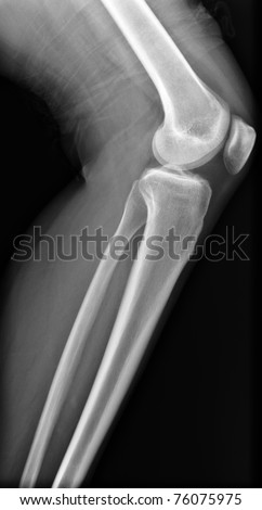 X-ray knee / Many others X-ray images in my portfolio.