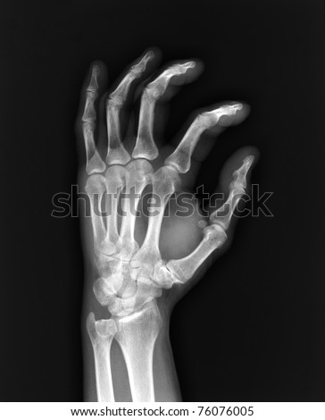 X-ray hand / Many others X-ray images in my portfolio.