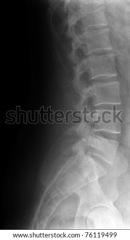 lumbar spine / Many others X-ray images in my portfolio.