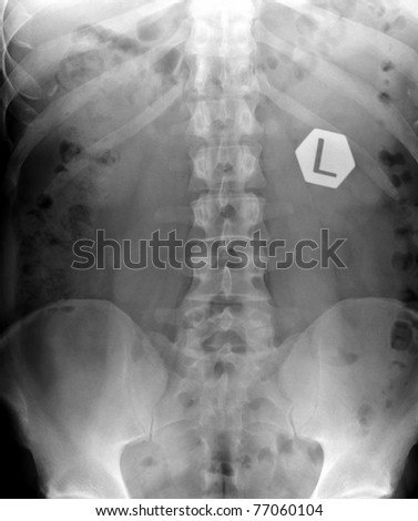 X -ray of spine and pelvis  / Many others X-ray images in my portfolio.