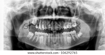 Dental MRI X-ray Closeup of the human skull and Teeth