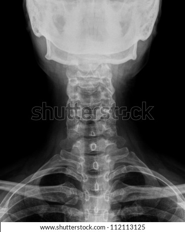 human neck bone and skull xray picture