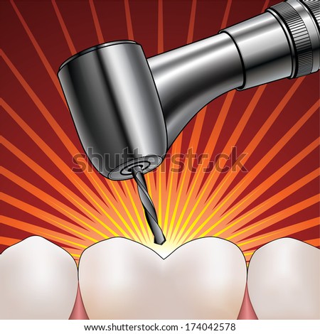 Dentist Drilling Tooth is an illustration of a shiny reflective silver dentist drill drilling an extremely painful tooth.
