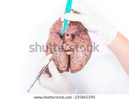 a medical student is showing the crossing of the ophtalmic nerve on a human brain