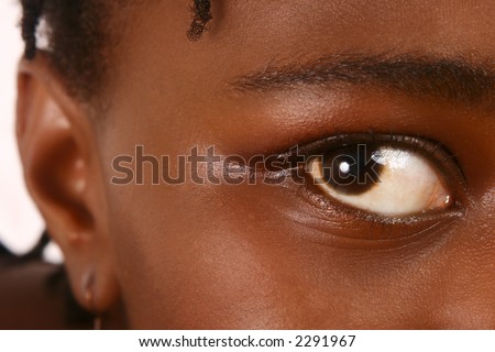 Close-up of an eye of a person.  Shallow D.O.F ? only the eye in focus, background and ear out of focus