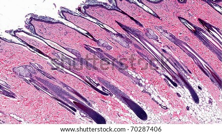 Skin showing hair follicles and sebaceous glands - Microscopic anatomy
