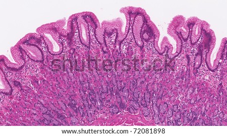 Fundic stomach showing parietal and chief cells